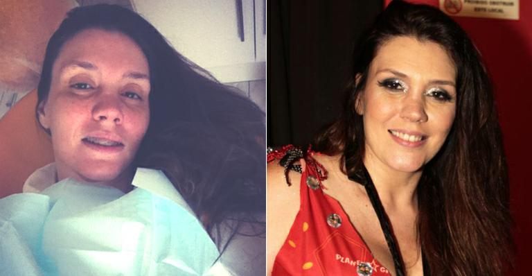 Simony posta foto sem make no dentista e é elogiada por fãs