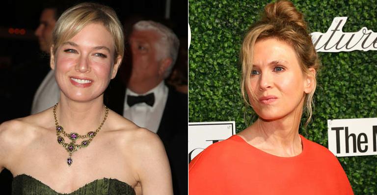 Efeito botox: Renée Zellweger aparece irreconhecível em evento