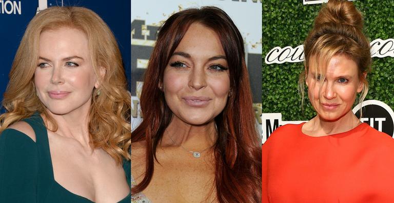 Veja como eram as celebridades antes do botox!