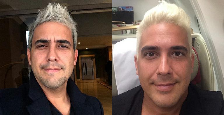 André Marques conta que ‘acidente doméstico’ deixou seu cabelo cinza