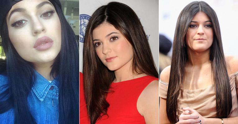 Aos 17 anos, Kylie Jenner, irmã de Kim Kardashian, transforma radicalmente os lábios e gera polêmica