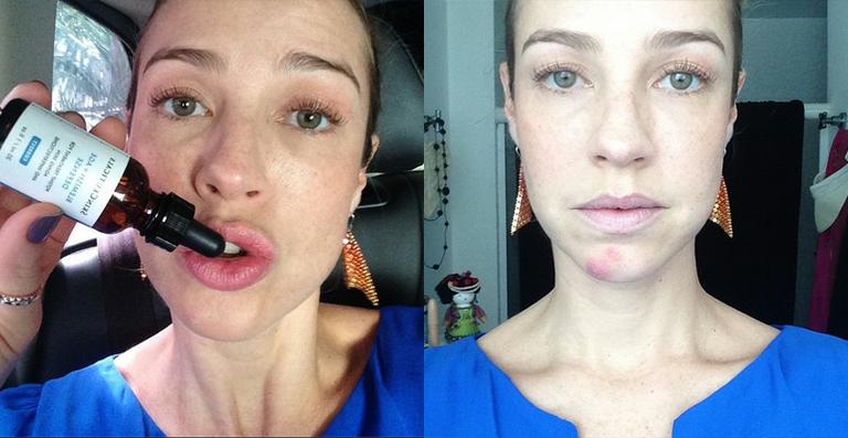 De cara lavada, Luana Piovani faz selfie para mostrar espinha: ‘Amo ser normal’