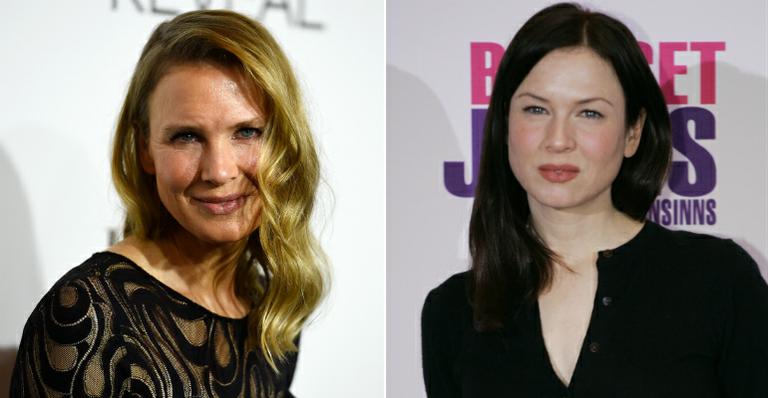 Renée Zellweger exagera no botox e surge irreconhecível em evento