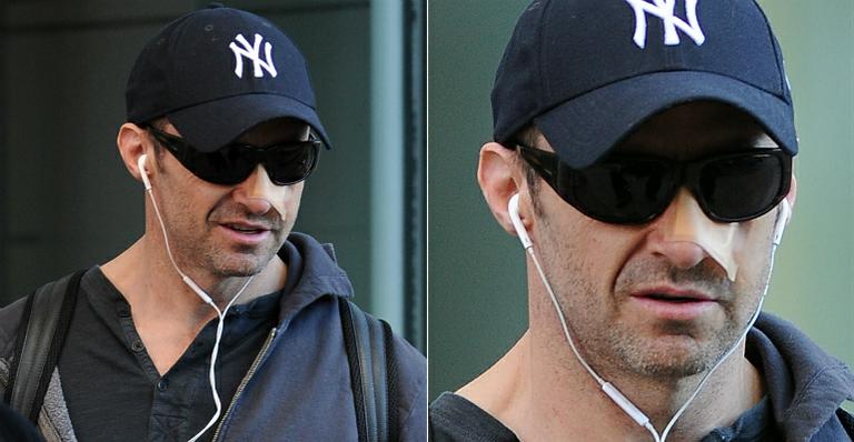 Em tratamento contra câncer de pele, Hugh Jackman é visto com curativo no nariz