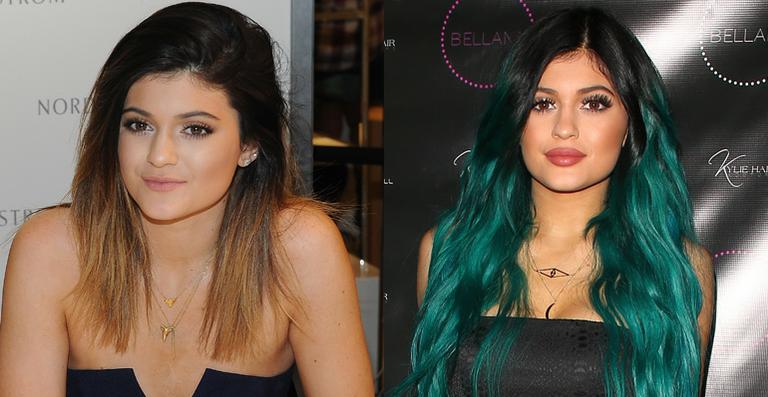Aos 17 anos, irmã caçula de Kim Kardashian chama atenção por lábios volumosos