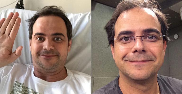 Humorista Carioca está internado após reação alérgica