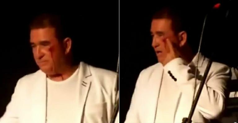 Após pedrada de gelo em show, Amado Batista lamenta: “As pessoas não se respeitam mais”