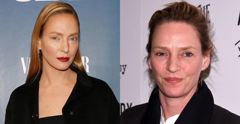 Uma Thurman aparece quase irreconhecível após tratamento estético