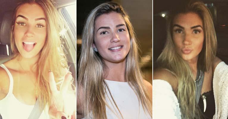 Especialista afirma que sobrancelha de Aline Gotschalg, do BBB 15, precisa ser refeita