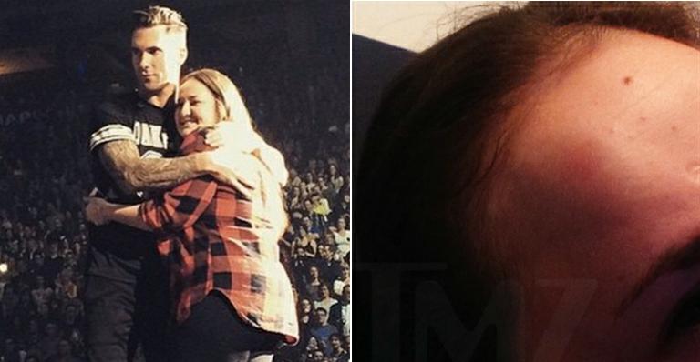 Adam Levine, vocalista do Maroon 5, acerta microfone na cabeça de fã