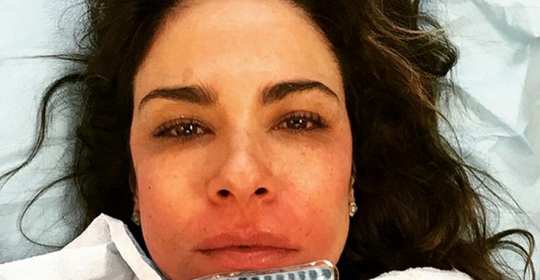 Luciana Gimenez faz procedimento estético e mostra rosto inchado: ‘Cara de pata’