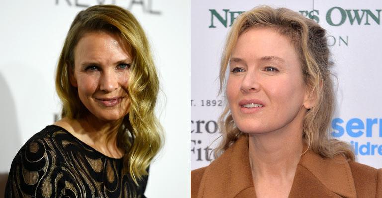 Um ano após causar polêmica com botox, Renée Zellweger surpreende em evento