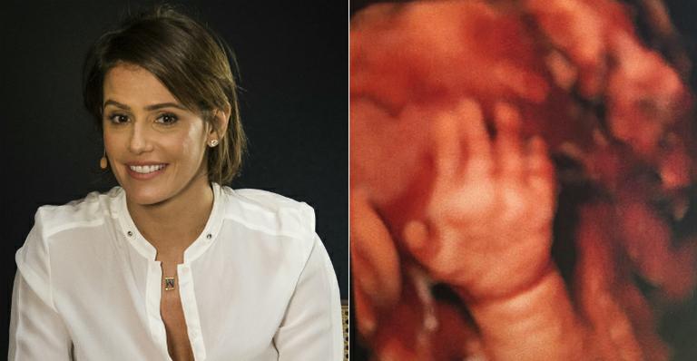 Deborah Secco mostra ultrassom da filha Maria Flor escondendo o rosto com a mão