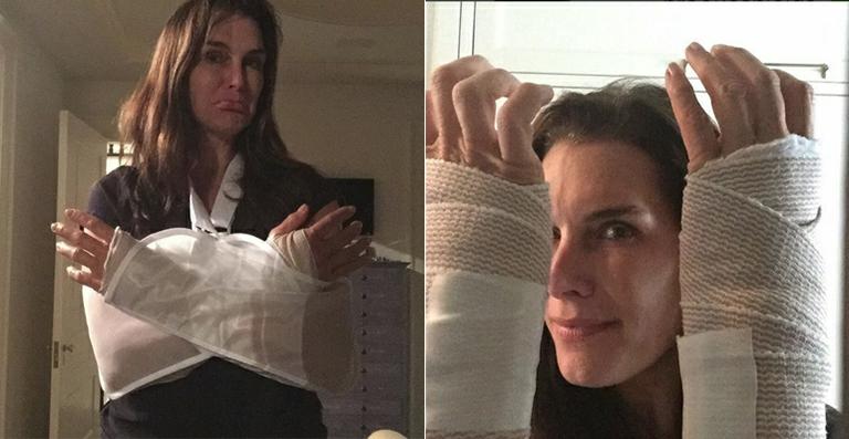 Brooke Shields faz cirurgia nos dois braços e mostra foto da recuperação