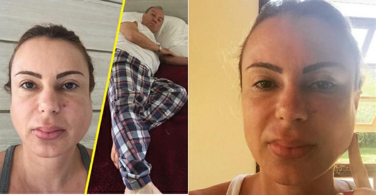 Marilene Saade, mulher de Stênio Garcia, sofre com caxumba e desabafa: “Vivo num lixão de vírus e corrupção”