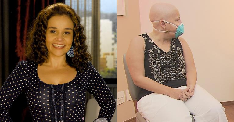 Cláudia Rodrigues fica careca após passar por transplante de células-tronco
