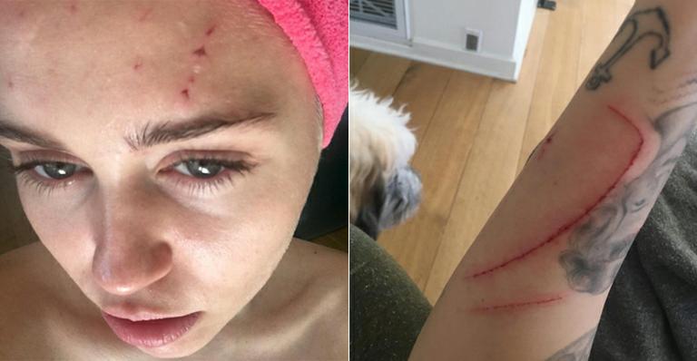 Miley Cyrus mostra arranhões após ‘ataque’ de gatos
