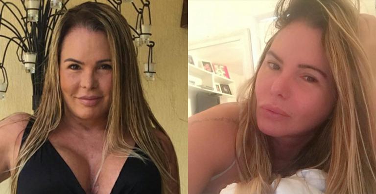 Cristina Mortágua mostra o rosto após cirurgia plástica para retirada de bochechas