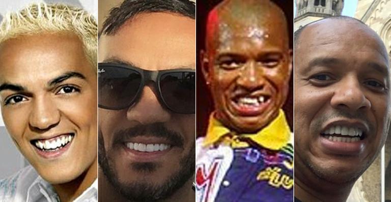 Saiba mais sobre o procedimento dentário de Belo e Anderson