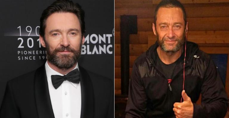 Hugh Jackman aparece mais velho e abatido em foto e fãs se preocupam!