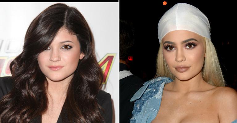Kylie Jenner comenta polêmica sobre seu preenchimento labial