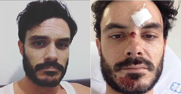 Ator de ‘Os Dez Mandamentos’ sofre acidente e relata drama nas redes sociais