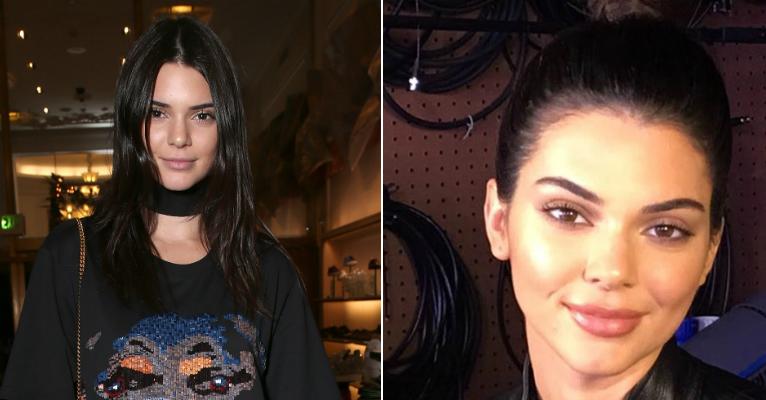 Kendall Jenner publica foto com lábios carnudos e fãs criticam preenchimento labial