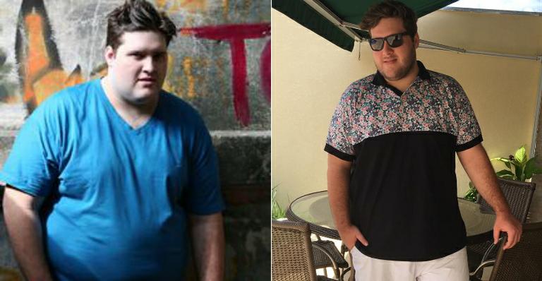 Felipe Hintze elimina dez quilos com tratamento: “Serei um gordinho com mais saúde”