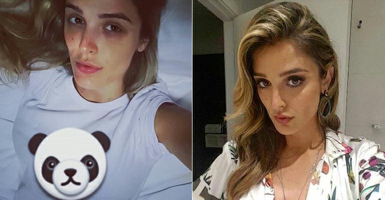 Cuidando do filho recém-nascido, Rafa Brites mostra diferença do rosto com e sem maquiagem