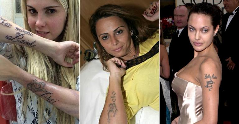 Especialista explica como funciona a técnica de remoção da tatuagem