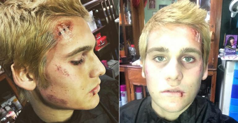 Nicolas Prattes surge ‘espancado’ em bastidores de filme