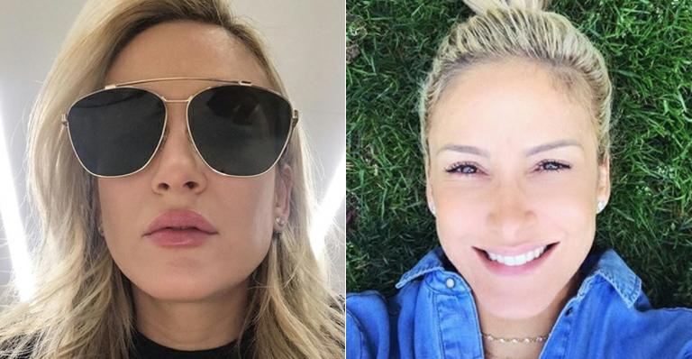 Fã pede para Claudia Leitte maneirar no preenchimento labial e ganha resposta surpreendente