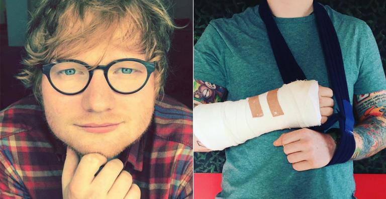 Ed Sheeran cancela shows após fraturar os dois braços