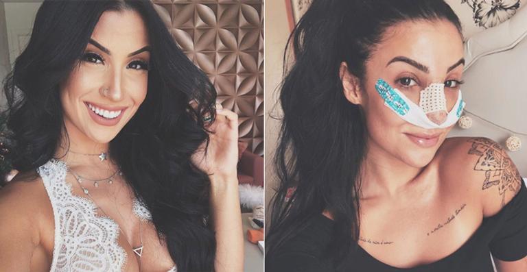 Bianca Andrade, a Boca Rosa, faz cirurgia no nariz e mostra fotos