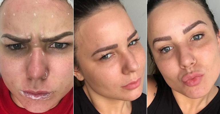 Cacau mostra resultado de preenchimento labial, botox e peeling aos 21 anos