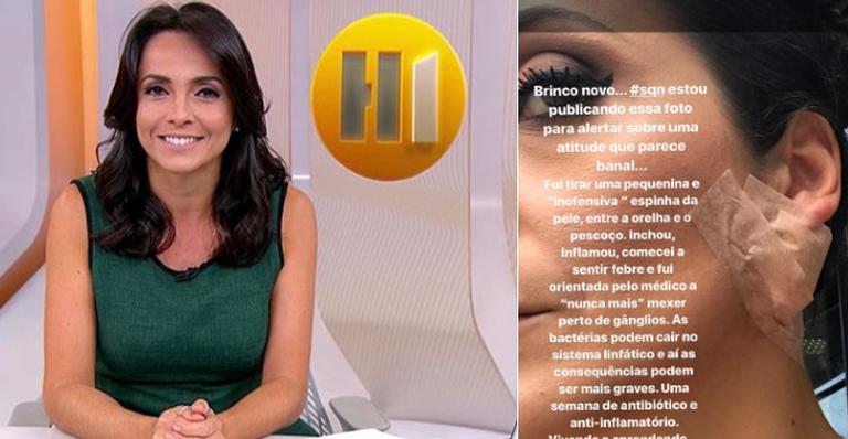 Apresentadora Izabella Camargo mexe em espinha e sofre séria inflamação na pele