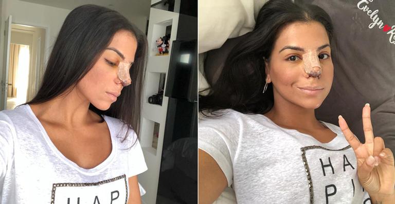 Evelyn Regly faz cirurgia no nariz e passa bem