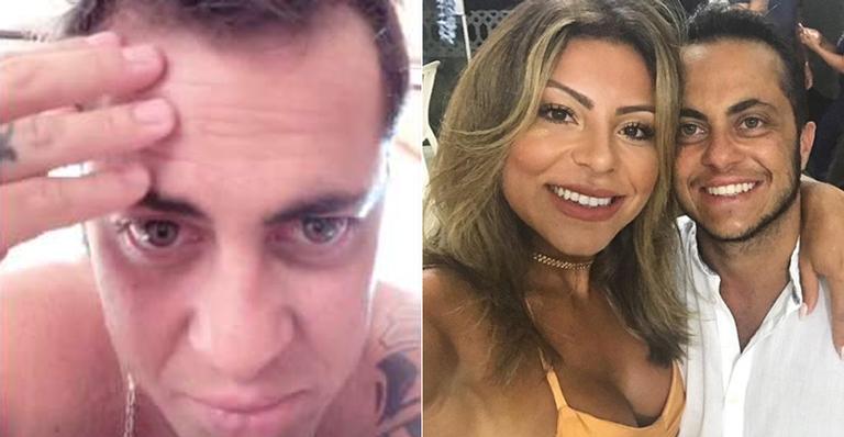 Aos 35 anos, Thammy Miranda reclama de calvície e namorada manda a real