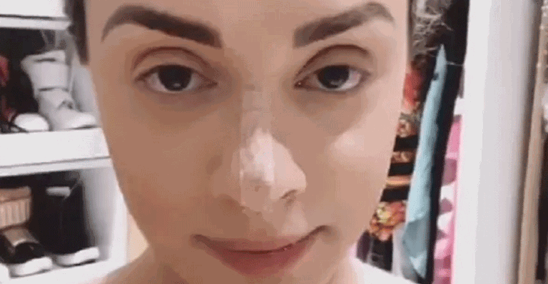 Juju Salimeni passa por rinomodelação para empinar o nariz: ‘Eu amei’