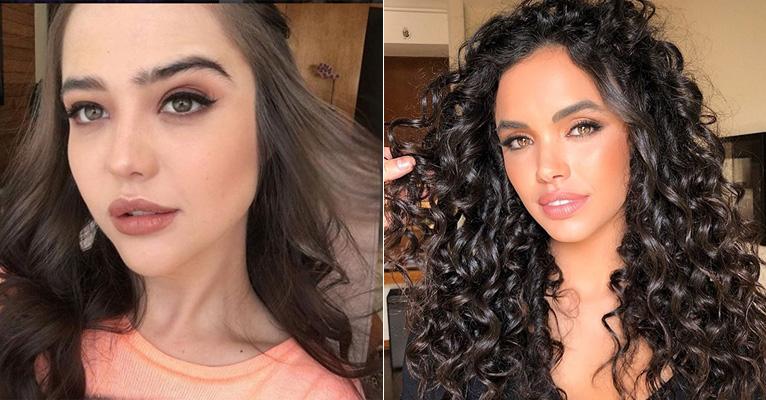 “V” acima do lábio é a nova tendência de beleza; saiba mais