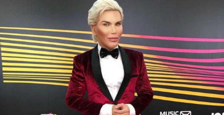 Após 60 plásticas, Rodrigo Alves, o Ken Humano, marca nova cirurgia