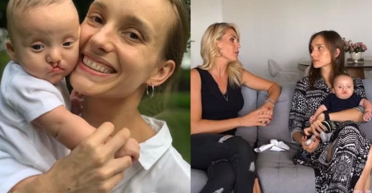 Filho de Isabel Hickmann passará por primeira cirurgia corretiva