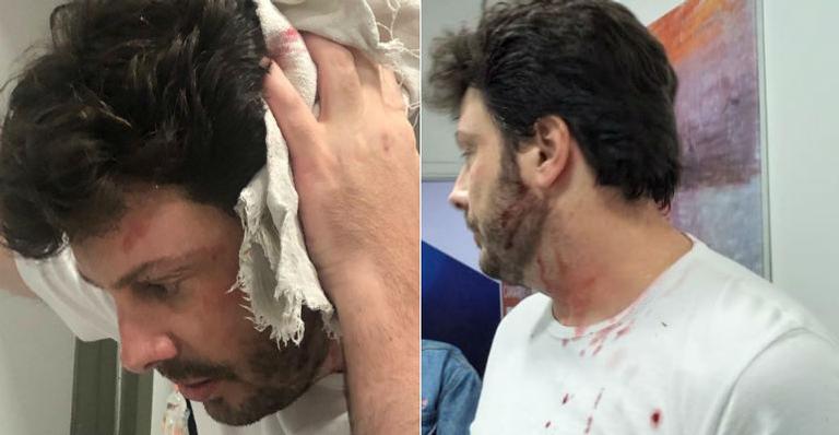 Danilo Gentili é agredido durante entrevista e sai sangrando da gravação: ”Péssima noite”