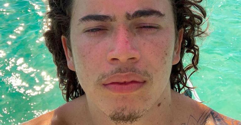 Whindersson Nunes conta sobre problema hormonal: ‘Acontecia a famigerada brochada’