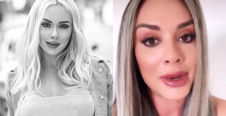 Juju Salimeni mostra antes e depois após harmonização facial: ”Amei”