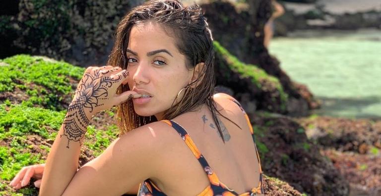 Assustada, Anitta descobre uma estria enorme em sua perna. ”Olha o tamanho disso!”