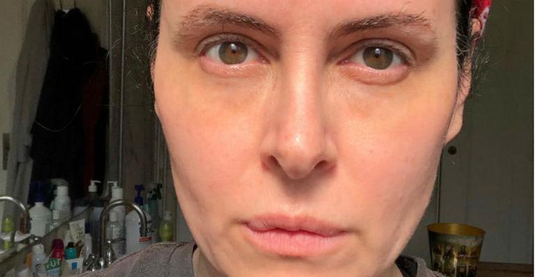 Morre a atriz Fernanda Young, aos 49 anos