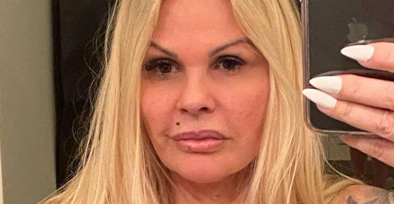 Monique Evans rebate críticas após procedimento estético: ”Só fiz preenchimento na boca”