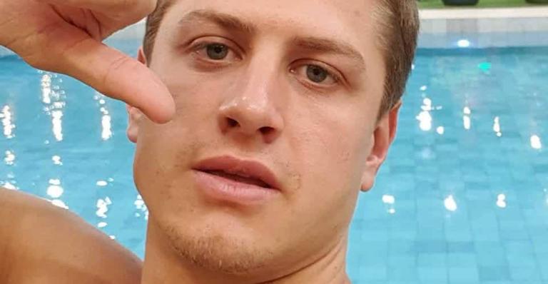 Lucas Gallina mostra antes e depois de preenchimento no maxilar e na boca