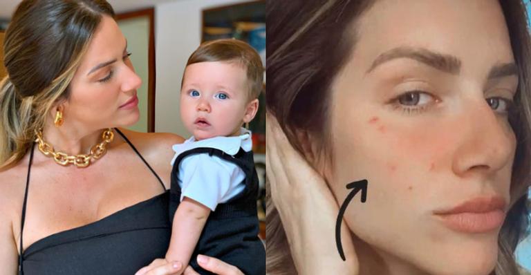 Giovanna Ewbank mostra seu rosto todo machucado e brinca: ”Arranhadinhos de amor do Baby Z”